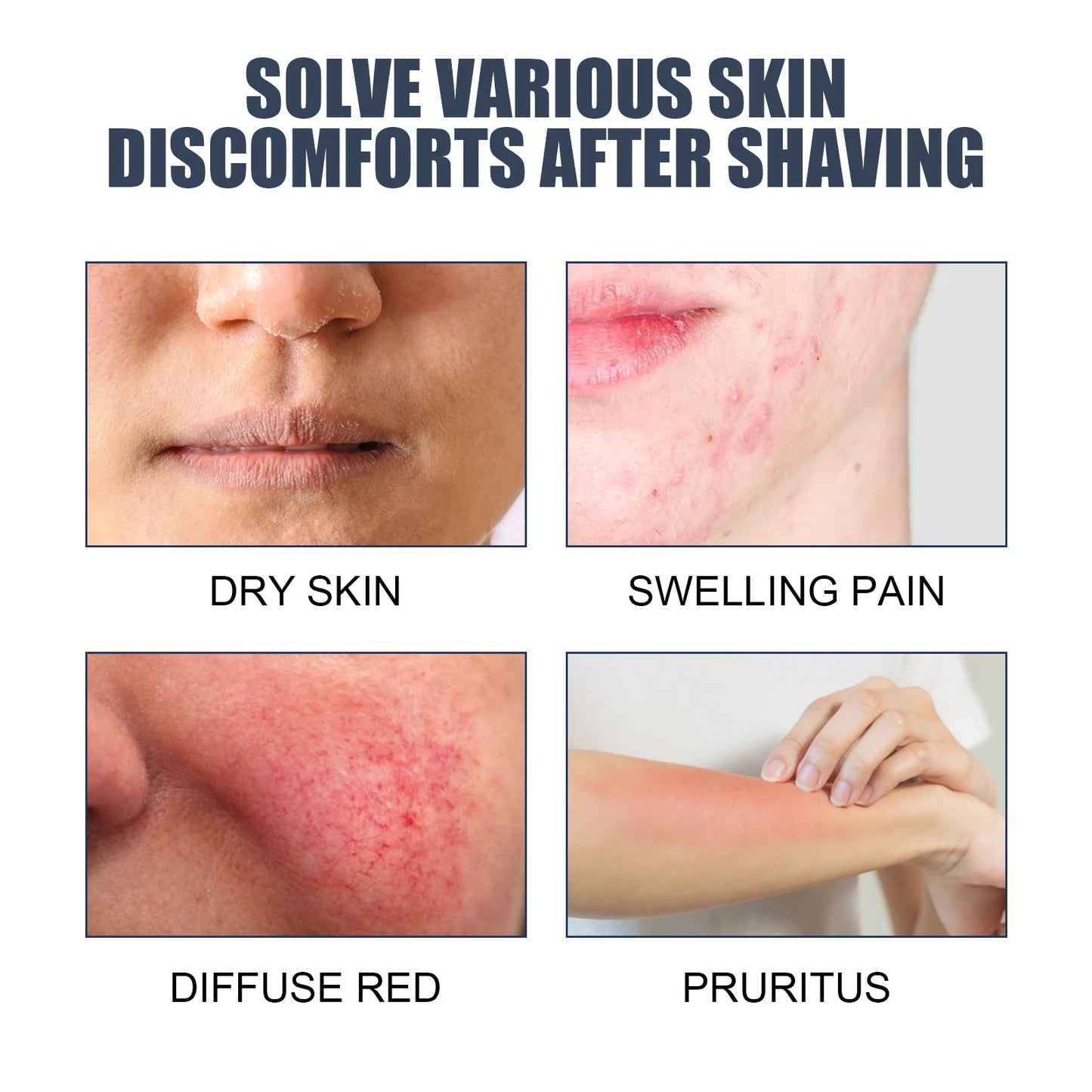 Men After Shave Cream Balm Post Shave Moisturizer For Skin Soothe Irritation Hydrating Face Lotion Non Greasy Fast Absorbing