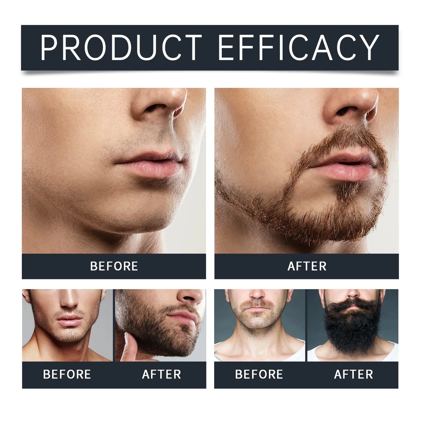 Beard Set for Men: Gentle Cleaning, Moisturizing, Repairing, and Manichaeism Care Set